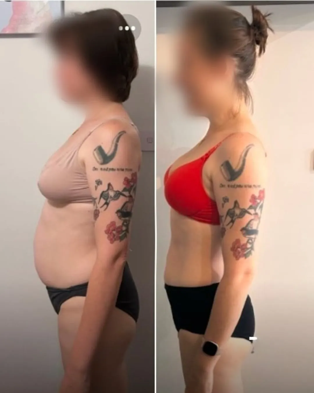 Client before and after, side on
